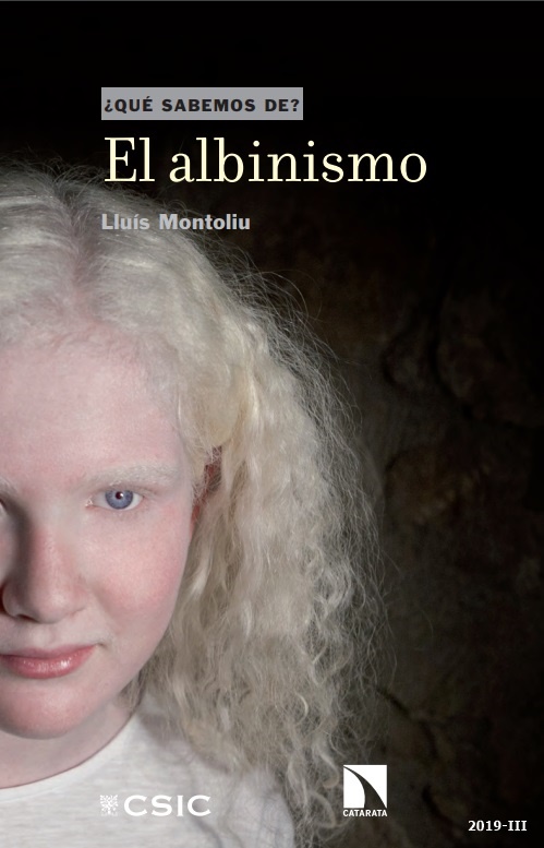 El albinismo