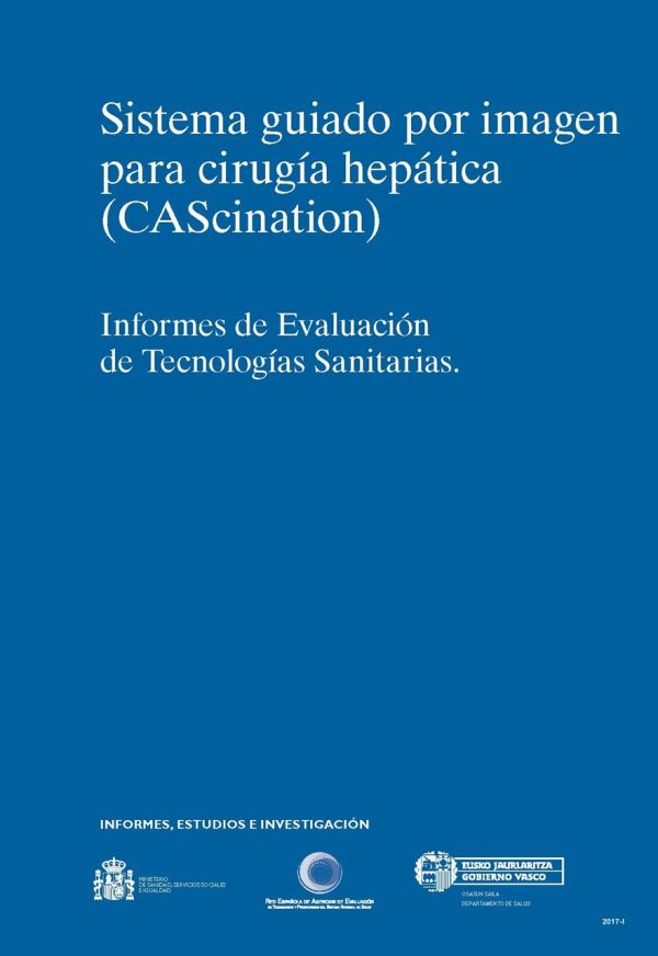 Sistema guiado por imagen para la cirugía hepática (CAScination)